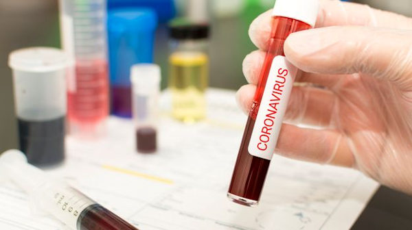 Coronavirus_isolato cepo italiano