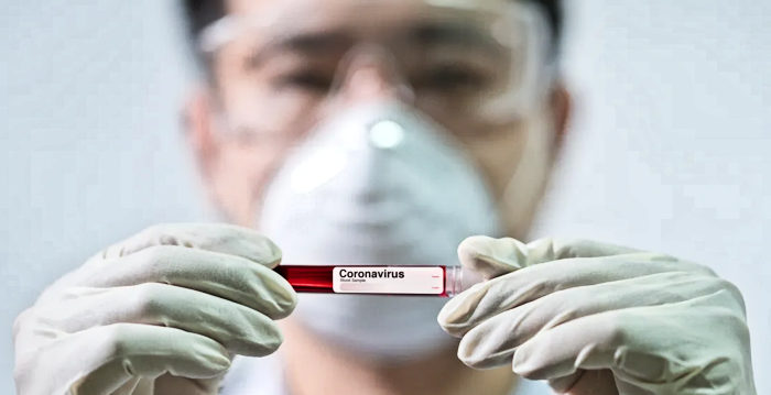 coronavirus_covid_19